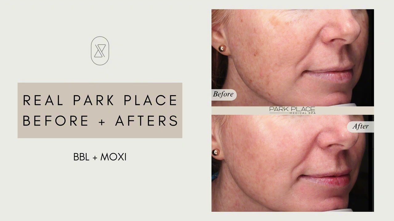 Park Place Medical Spa - Our Services