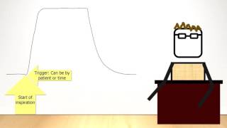 A Basic Introduction to Mechanical Ventilation: Chapter 2.7 - The Ventilation Cycle