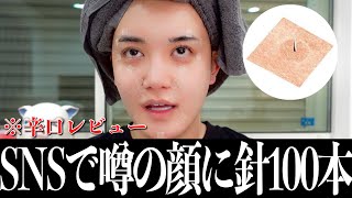 SNSでバズってる顔が小さくなる針を買って辛口レビューする