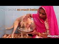 Dog's face disfigured in accident. Watch him become beautiful again.