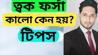 ত্বক ফর্সা কালো কেন হয়?কিভাবে ত্বকের উজ্জ্বলতা রক্ষা করবেন?How to care your skin? screenshot 3