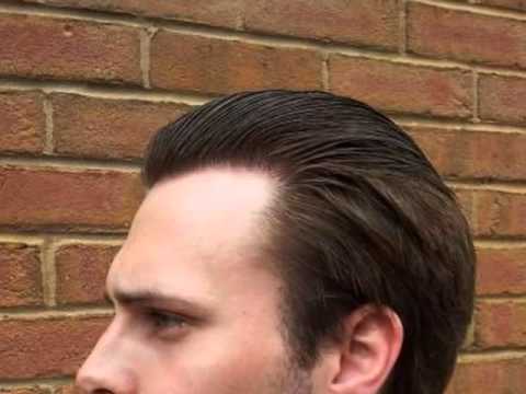 Chris Dav 1900 Grafts By Dr Feller You Chris Dav 1900 Grafts By Dr Feller