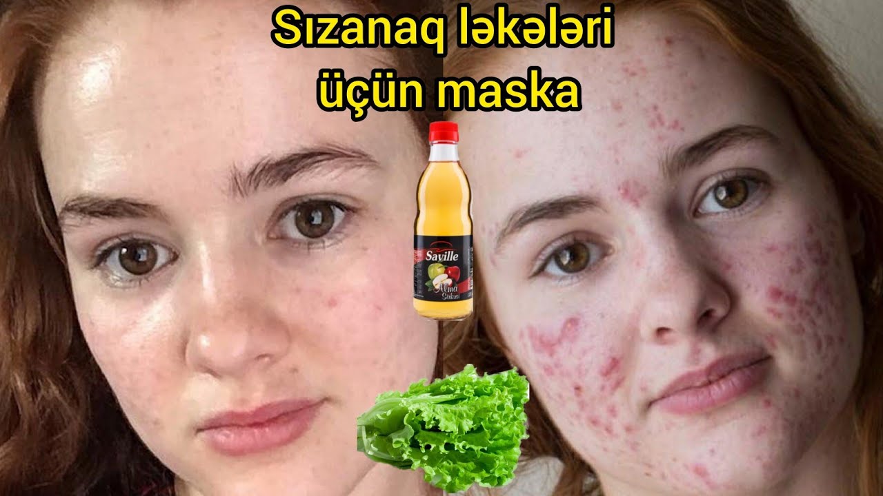 kişini