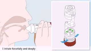 Asthma treatment: how to use a Turbuhaler