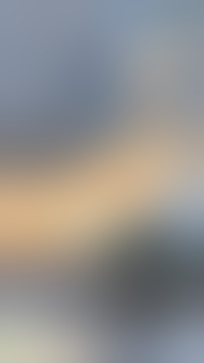 Download lagu Labia Majora Augmentation after Liposuction 🙌