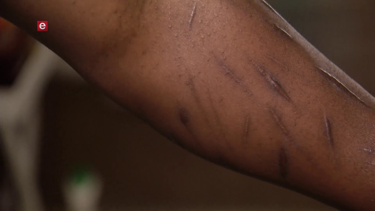 Checkpoint EP 227 eTV Topical scandalo magistratura