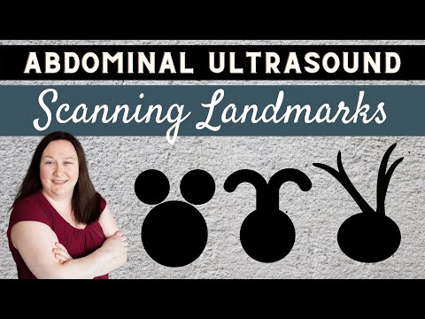Abdominal Ultrasound | Scanning Landmarks | #Sonographyminutes