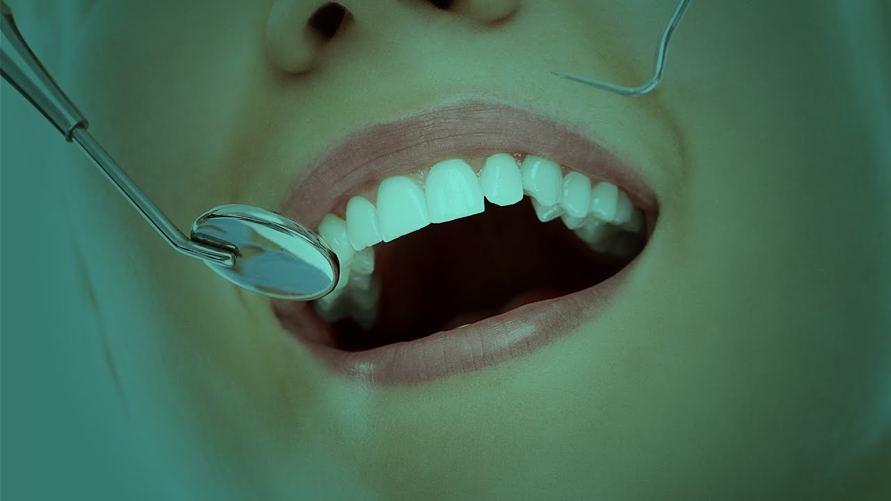 Expert Surgeries || Smile Makeover || İzmir Turkey