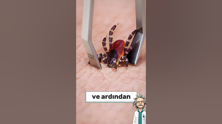 VÜCUTTAKİ KENE NASIL ÇIKARTILIR? 🐜