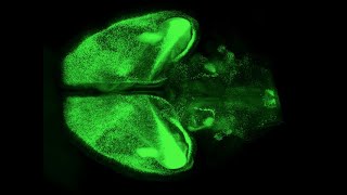 mesoSPIM animation