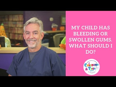 Video: Why Does The Child Have Red Gums