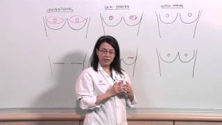 Types of Mastectomies: What is nipple-sparing reconstruction? - Sonia Sugg, MD