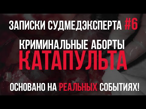 Записки Судмедэксперта #6 "Катапульта". История основана на Реальных Событиях!