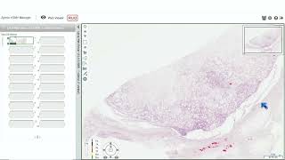 A Pattern-Based Approach to Soft Tissue Tumors, Part 1 by John R. Goldblum, M.D. screenshot 1