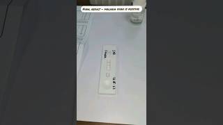 malaria antigen rapid test |apollo clinic ballygunge phari #shorts