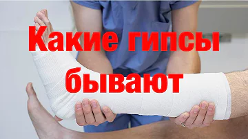 Какие гипсовые повязки бывают