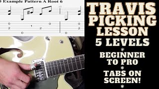 5 Levels of Travis Picking Lesson