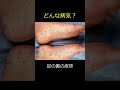 【梅毒】これって梅毒ですか? #shorts