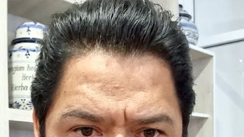 Soy Alfonso Campos Especialista En Fitoterapia