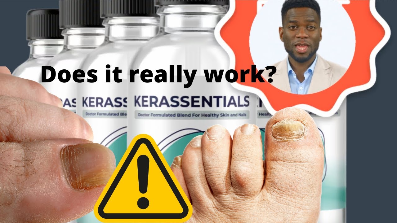 ⚠️⚠️Kerassentials Review – How Does Kerassentials Work?  Kerassentials Reviews ⚠️⚠️