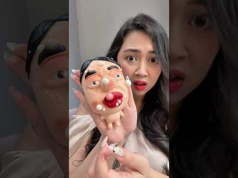 PENCET JERAWAT JUMBO SERU WKWK | Klara Tania #shorts