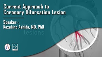 Current Approach to Coronary Bifurcation Lesion