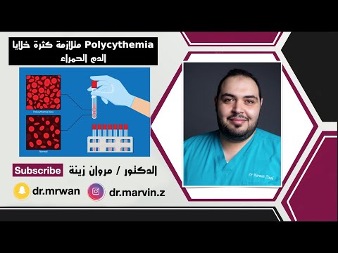 Polycythemia مرض كثرة خلايا الدم الحمراء