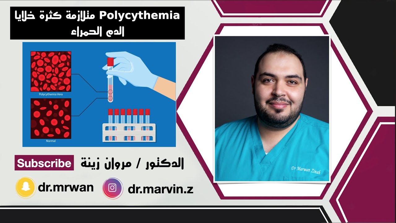 Polycythemia متلازمة كثرة خلايا الدم الحمراء