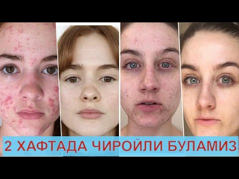 Kurganinsk porno rasmlar