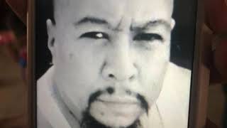 Bite Of Terror Man Left Disfigured After Girlfriend Bit His Lip Off