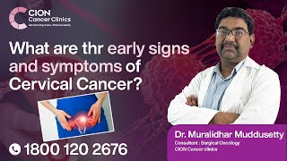 Play video: What are the early signs and symptoms of cervical cancer