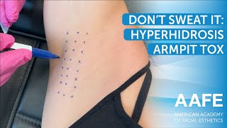 Don't Sweat It: Hyperhidrosis Armpit Tox