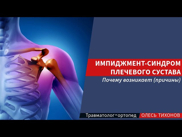 Импиджмент синдром плечевого сустава - причины почему возникает