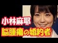 【小林麻耶】脳腫瘍の婚約者を持つブログ読者にアドバイス「頑張りすぎない」