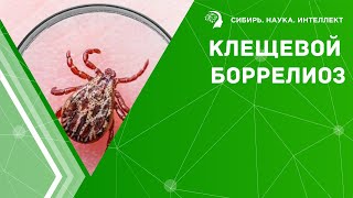 Клещевой боррелиоз