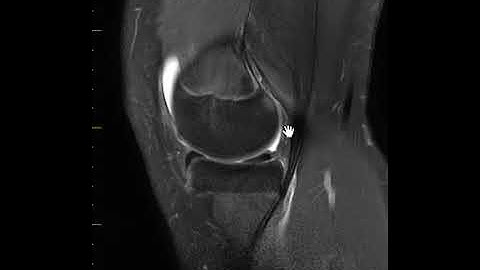 Test your pattern recognition 1