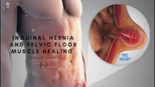 Inguinal Hernia and Pelvic Floor Muscle Scalar Energy Healing - Rife Frequency©