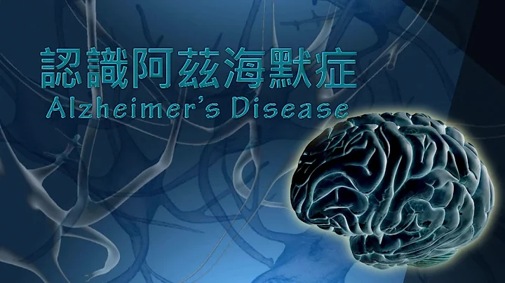【科普教育】认识阿兹海默症 - 国语版 - 天天要闻