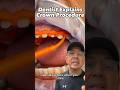 Dental Crown Procedure (How Long Does It Take to Get a Crown?) | View Mobile Dental #shorts
