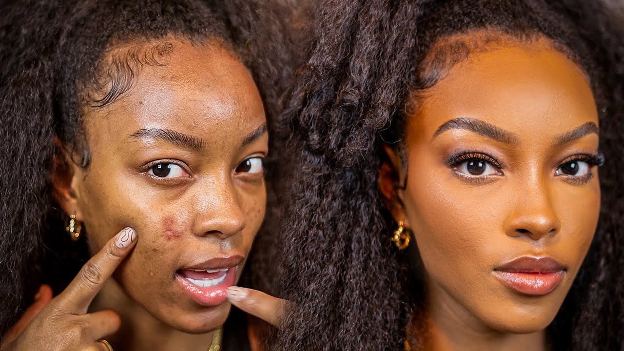 How to Cover Up Acne Blemishes and Active Acne! YouTube
