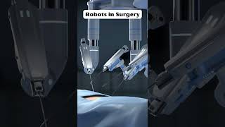 Robots in Surgery: Safer Than Doctors?