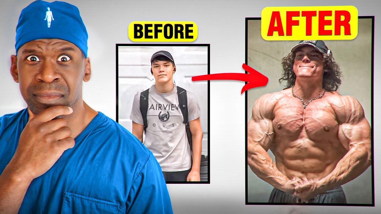 This Is Why Young Men LOVE Steroids | Surgeon Explains PED’s Concerning Rise In Popularity