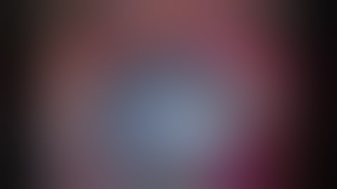 4-0395T Capsulorhexis Forceps with SCALE. Capsulorrexis con Utrata Rumex incision 1,5mm