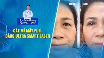 Cắt mí full không sưng bằng công nghệ ultra smart laser | Bác Sĩ Lê Quang
