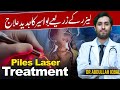 Piles laser surgery  bawaseer laser operation now available  best laser surgeon in karachi