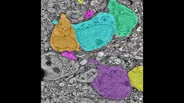 Multimedia Video 1. Layers of Reconstruction via Volume Annotation and Segmentation Tool.