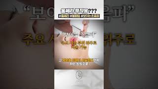 울쎄라 볼패임 걱정? 요즘은 기술이 다릅니다!_[아르노피부과]