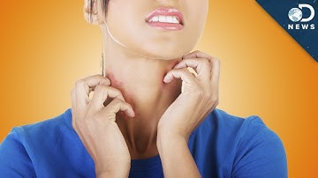 Why Scratching An Itch Makes It Worse