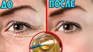 Избавьтесь от МОРЩИН Легко и Быстро! Всего ОДНА КАПЛЯ этого МАСЛА разгладит МОРЩИНЫ вокруг ГЛАЗ... Избавьтесь от МОРЩИН Легко и Быстро! Всего ОДНА КАПЛЯ этого МАСЛА разгладит МОРЩИНЫ вокруг ГЛАЗ...