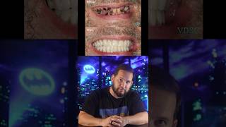 The TikTok Dental Scam Ruined Lives!
